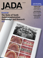 The Journal of the American Dental Association Issue cover for Volume 155, Issue 6 June 2024